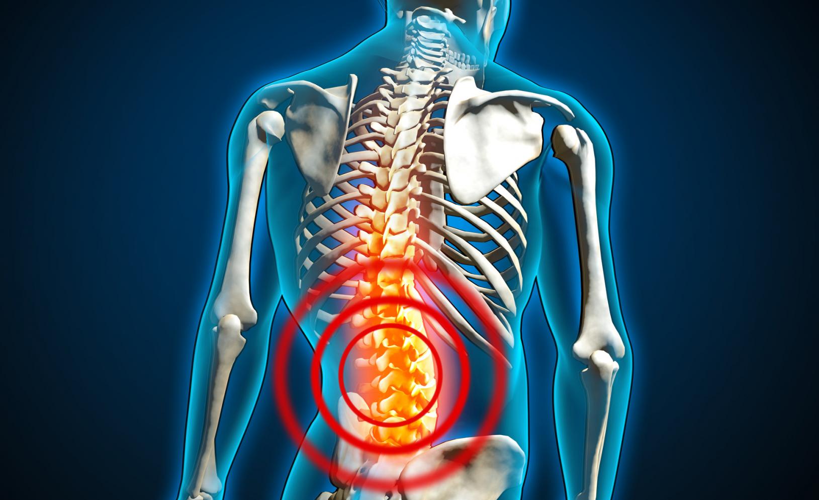 Animation eines menschlichen Skeletts mit roten Kreisen um den unteren Rückenbereich, die auf Rückenschmerzen hinweisen.