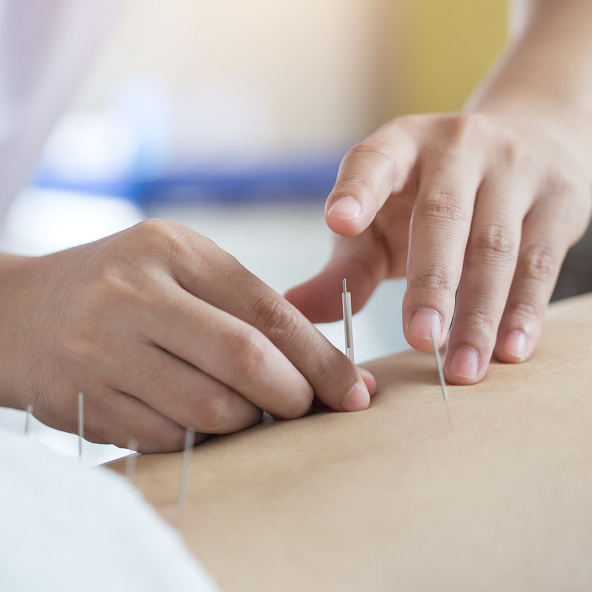 Traditionelle Chinesische Medizin (TCM) im medicos.AufSchalke - ambulante Reha & mehr in Gelsenkirchen!